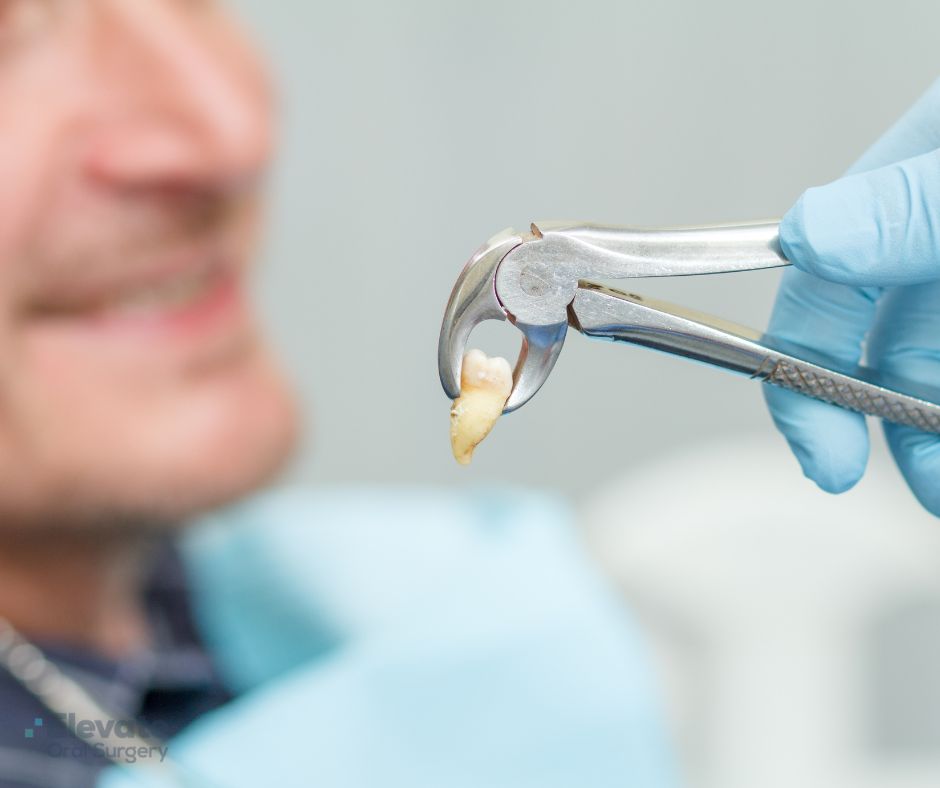 Elevate Oral Surgery - Tooth Extraction in Northern Virginia