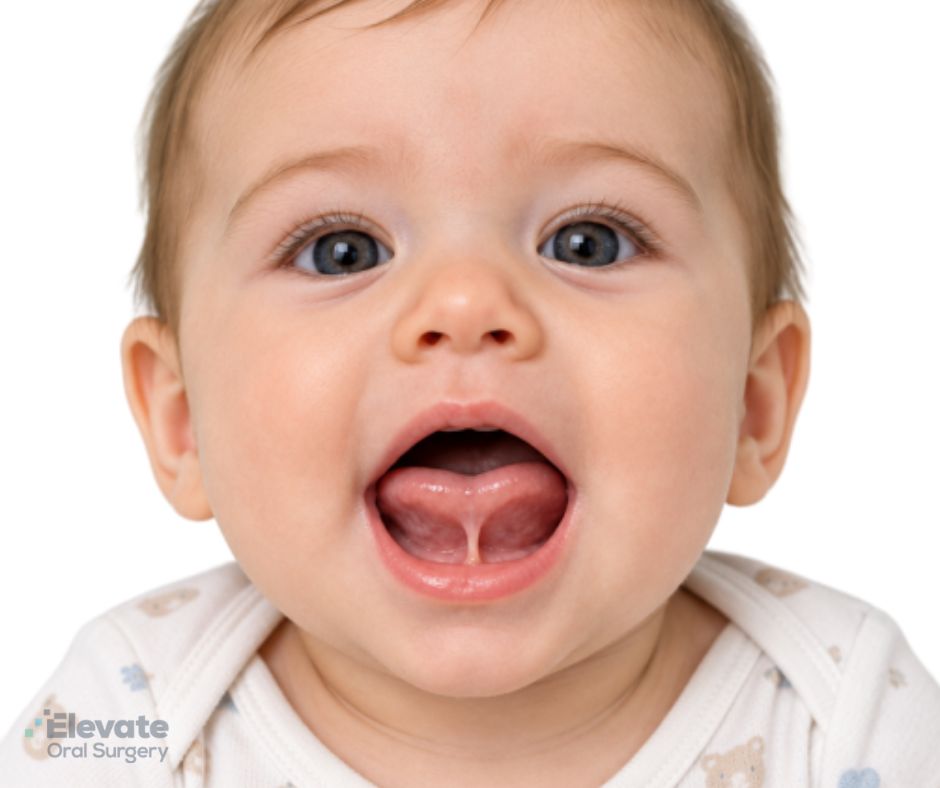 Elevate Oral Surgery - tongue tie revision in Northern Virginia
